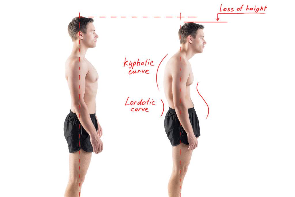 posture-analysis